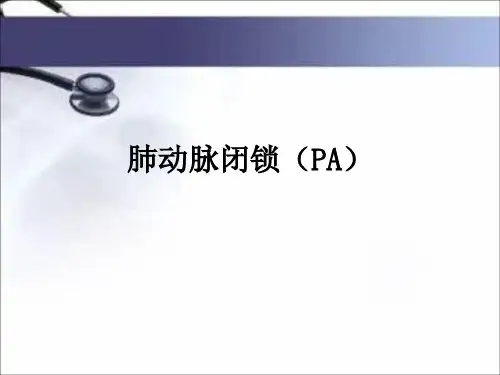 肺动脉闭锁