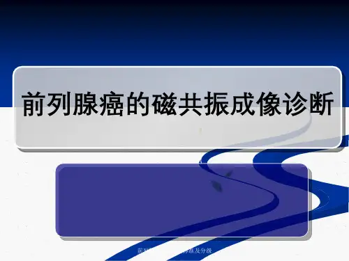 前列腺癌MRI诊断标准及分级