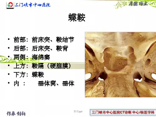 垂体解剖及垂体瘤