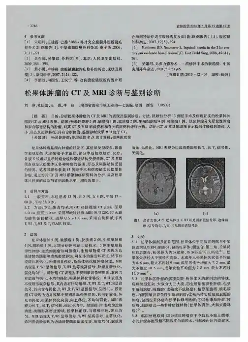 松果体肿瘤的 CT 及 MRI 诊断与鉴别诊断