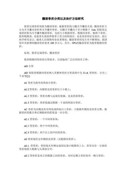 髋部骨折分类以及治疗方法研究