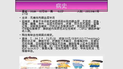 膀胱癌病人的护理PPT课件