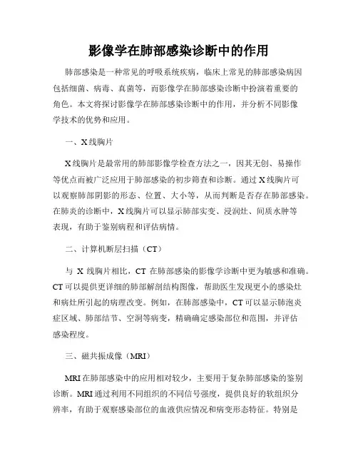 影像学在肺部感染诊断中的作用