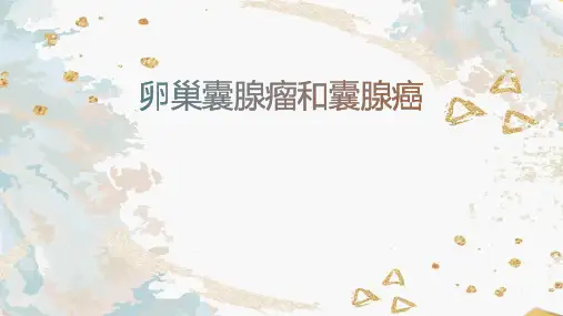 卵巢囊腺瘤和囊腺癌的影像表现