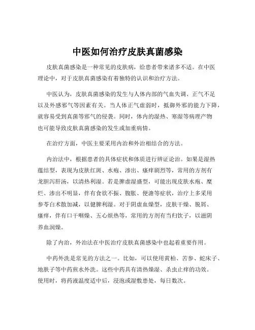 中医如何治疗皮肤真菌感染