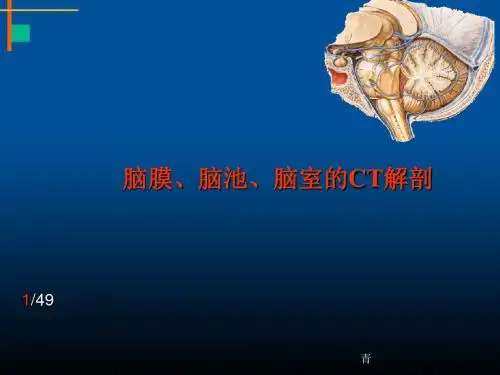 脑膜、脑池、脑室CT解剖医学PPT课件