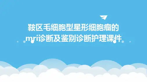 鞍区毛细胞型星形细胞瘤的MRI诊断及鉴别诊断护理课件