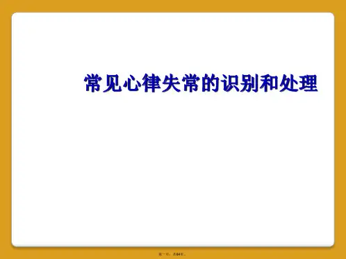常见心律失常的识别和处理