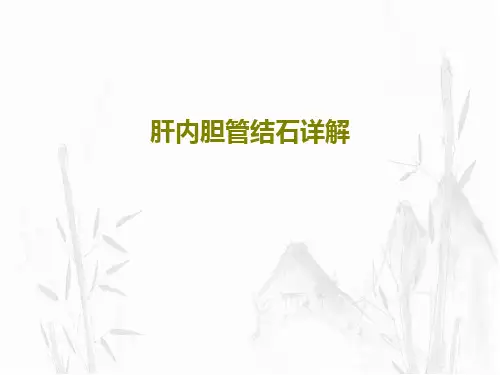 肝内胆管结石详解共23页