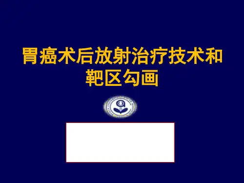 【肿瘤放射治疗学习课件】_胃癌放射治疗技术和靶区勾画