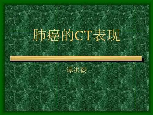 肺癌的CT表现PPT课件