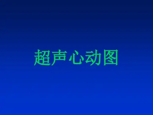 超声心动图