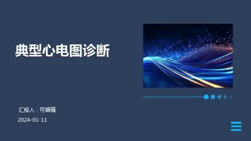 典型心电图诊断