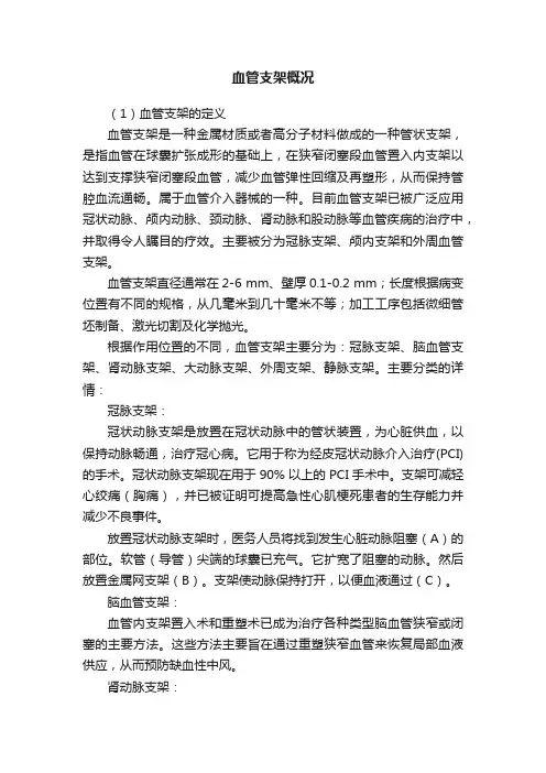 血管支架概况