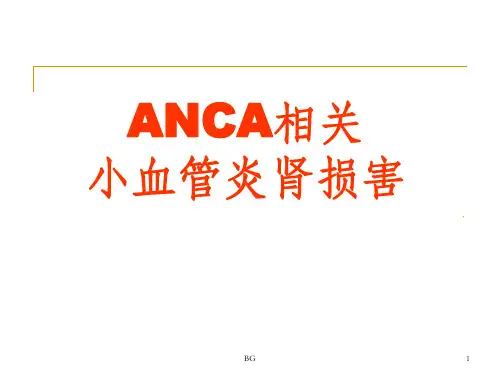 ANCA相关小血管炎