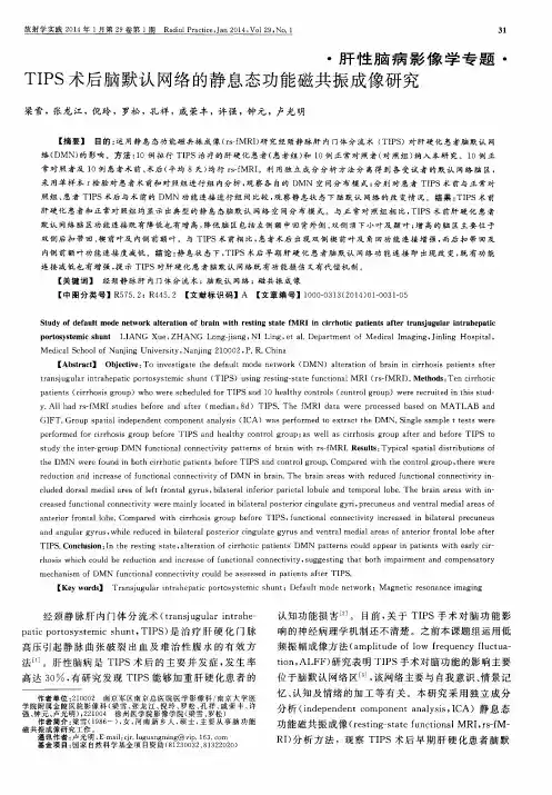 TIPS术后脑默认网络的静息态功能磁共振成像研究