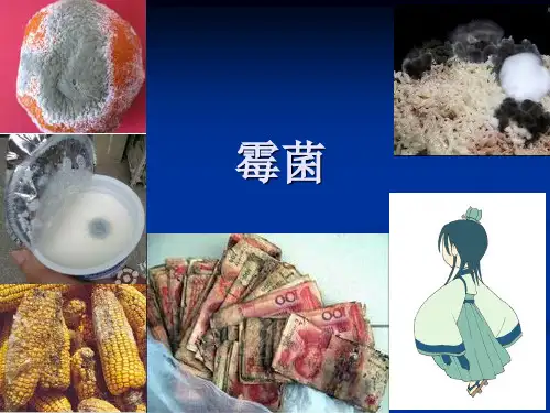 霉菌PPT精选课件