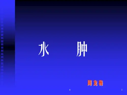 水肿中医护理查房ppt课件