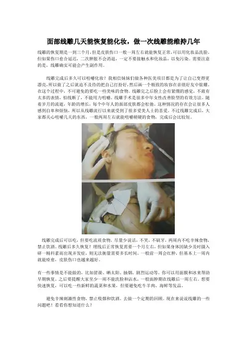 面部线雕几天能恢复能化妆,做一次线雕能维持几年