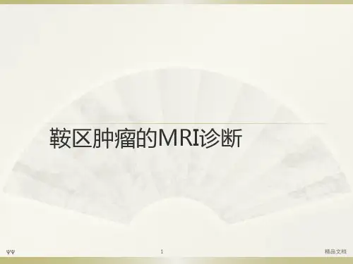 鞍区肿瘤影像诊断PPT课件
