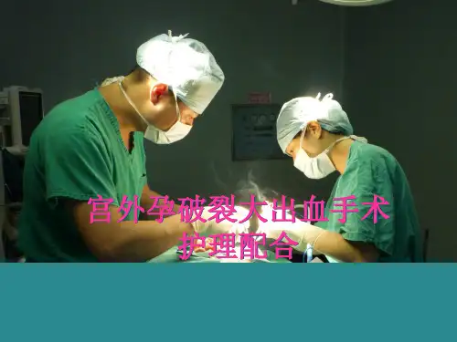 宫外孕护理查房PPT演示课件