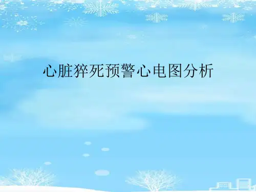心脏猝死预警心电图分析