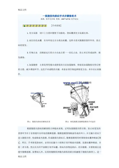 (整理)一般腹股沟斜疝手术步骤修复术.