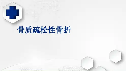 骨质疏松性骨折PPT课件[文字可编辑]