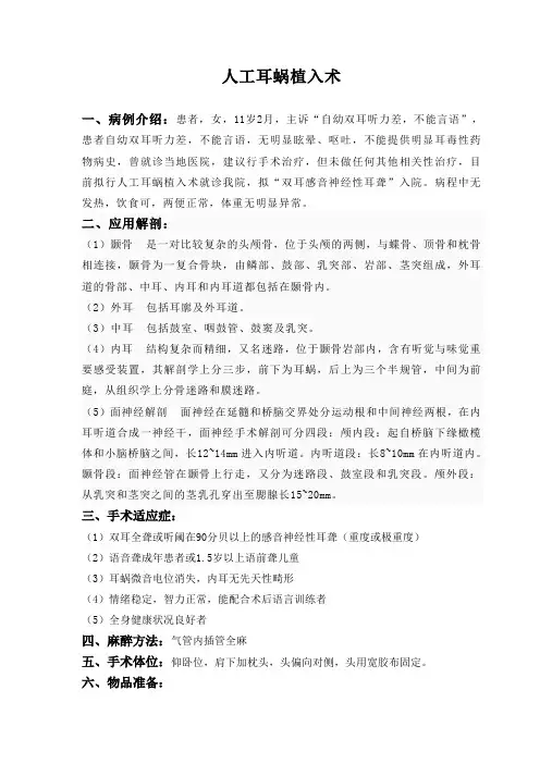 人工耳蜗植入术
