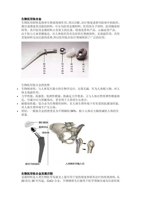 带你简单却全面的认识生物医用钛合金