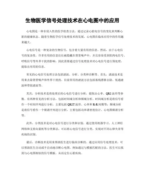 生物医学信号处理技术在心电图中的应用