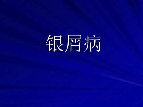 银屑病 PPT课件