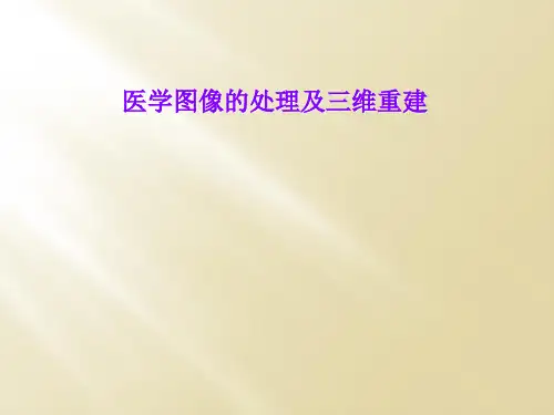 医学图像的处理及三维重建