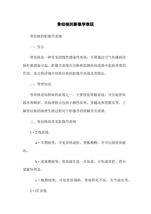 骨结核的影像学表现