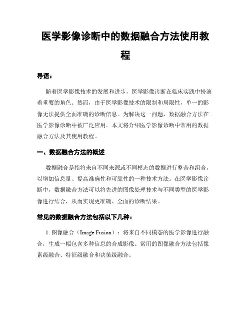 医学影像诊断中的数据融合方法使用教程