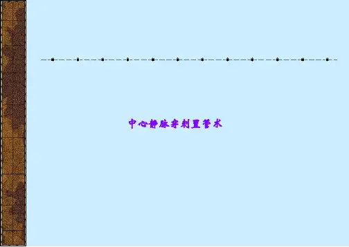 中心静脉穿刺置管术