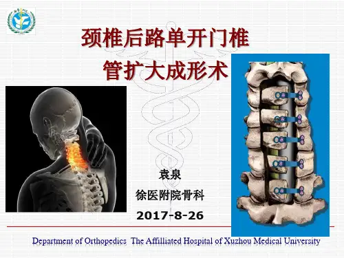 颈椎后路单开门椎管扩大成形术(yq)