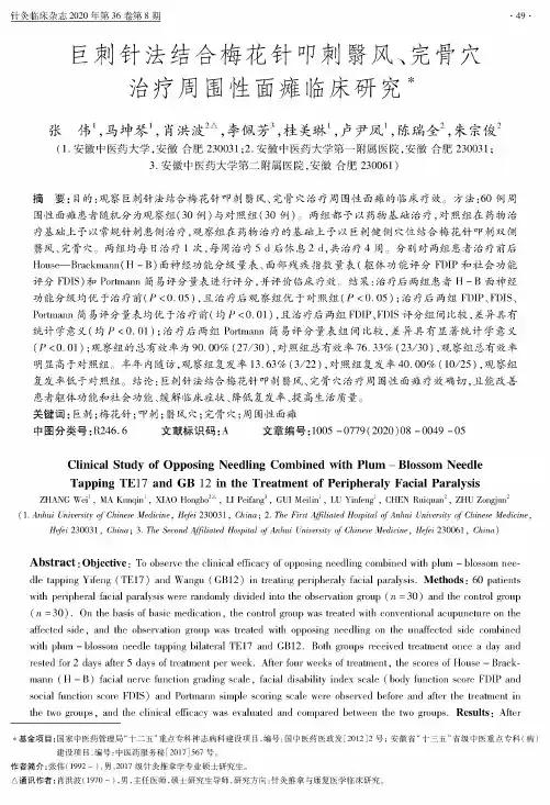 巨刺针法结合梅花针叩刺翳风、完骨穴治疗周围性面瘫临床研究
