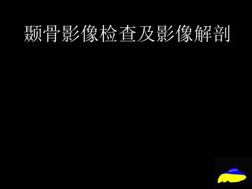 (完整版)颞骨影像检查及影像解剖