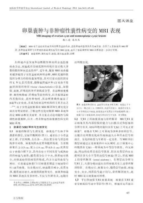 卵巢囊肿与非肿瘤性囊性病变的MRI表现