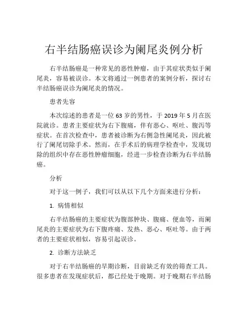 右半结肠癌误诊为阑尾炎例分析