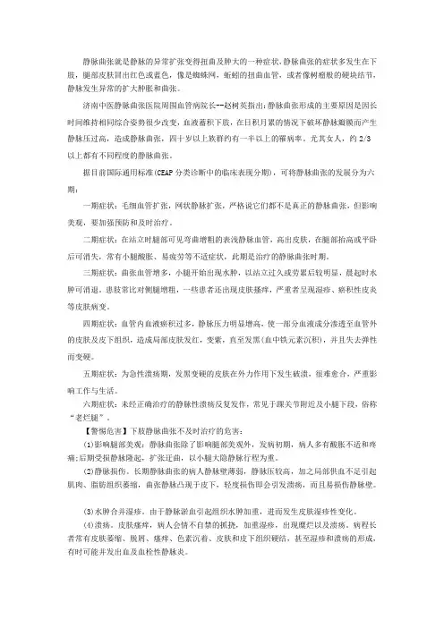 静脉曲张症状