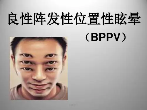 良性阵发性位置性眩晕(耳石症)  ppt课件