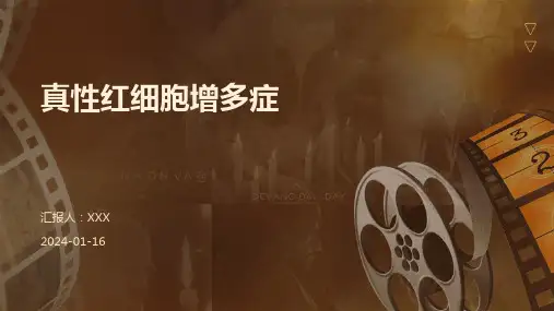 真性红细胞增多症疾病PPT演示课件