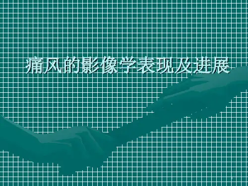 痛风影像学表现及进展