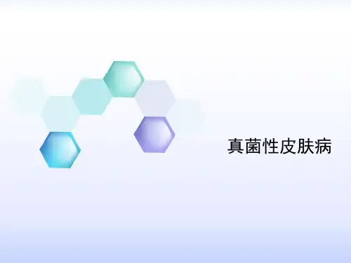 真菌性皮肤病