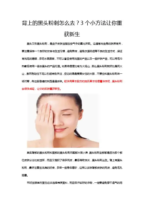 背上的黑头粉刺怎么去？3个小方法让你重获新生