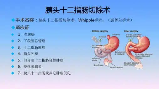 胰腺、十二指肠手术麻醉ABC