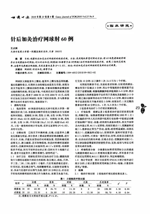 针后加灸治疗网球肘60例