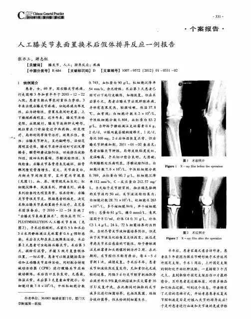 人工膝关节表面置换术后假体排异反应一例报告